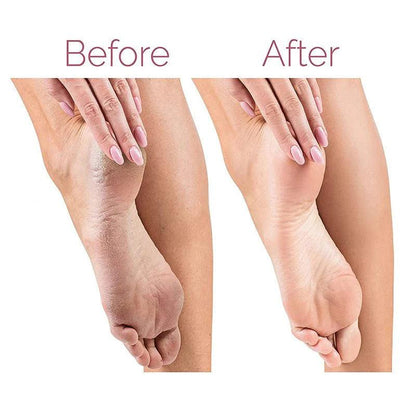 Effortless Smooth Feet with Electric Pedicure Foot File & Callus Remover! - AL-Mustafa-Zone